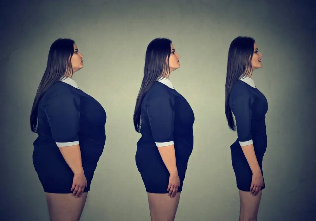 Medical Weight Loss Program Islamabad
